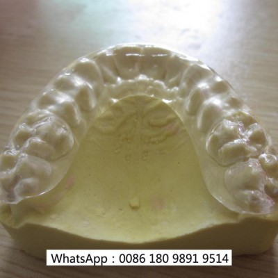 深圳义齿牙齿透明牙套保持器定制3D牙模数据 3D打印牙齿模型
